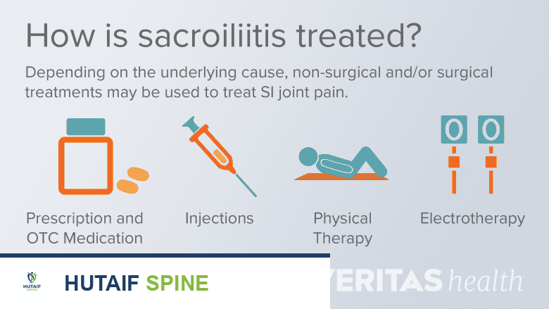 صورة طبية: التهاب المفصل العجزي الحرقفي كل ما تحتاج لمعرفته مع الأستاذ الدكتور محمد هطيف