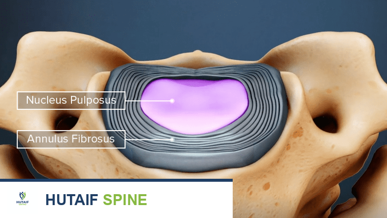 منظر علوي لقرص عنقي مع تسميات