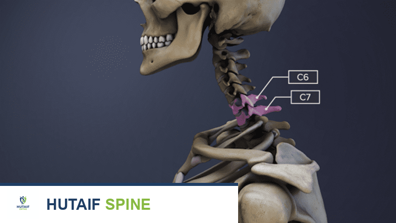 كل ما تحتاج معرفته عن الفقرات العنقية C6-C7: التشريح، المشاكل، والعلاج مع الأستاذ الدكتور محمد هطيف