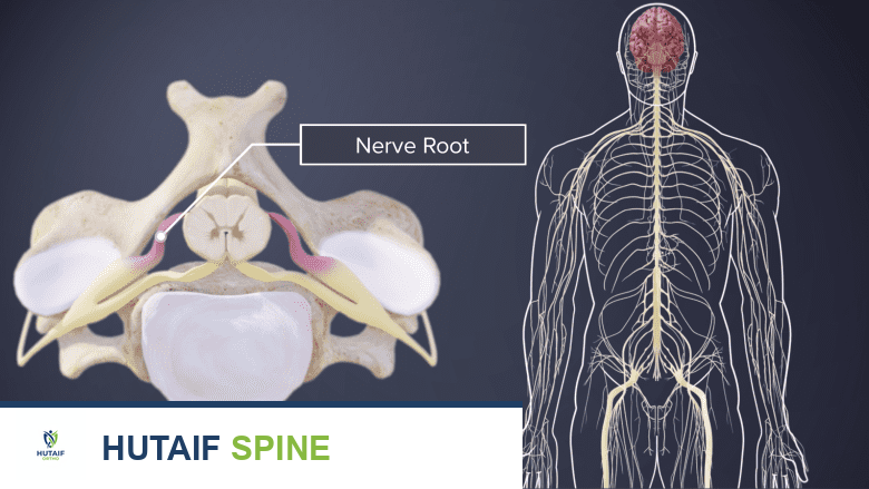 صورة توضيحية علوية للفقرات العنقية مع تسمية جذر العصب، بجانب رسم بياني لأعصاب الجسم.