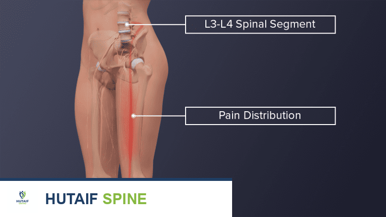 صورة طبية: كل ما تحتاج معرفته عن الفقرات القطنية L3-L4: دليل شامل لآلام الظهر وتشخيصها وعلاجها
