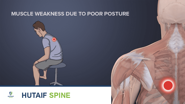 رسم توضيحي يظهر رجلاً جالسًا بوضعية سيئة مع نقطة حمراء في منطقة أعلى الظهر.