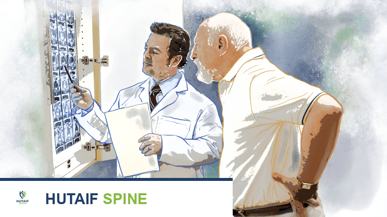 التهاب الفقار (Spondylosis): دليلك الشامل لفهم الأسباب والعلاج مع الأستاذ الدكتور محمد هطيف