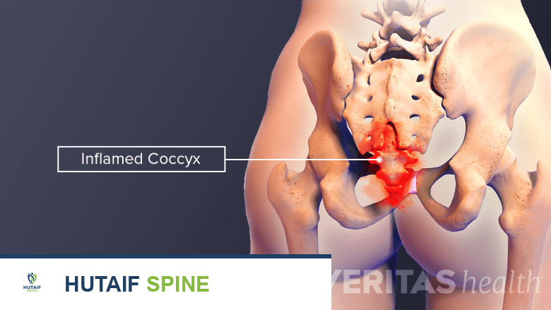 صورة توضيحية لـ آلام الظهر بعد الولادة: دليل شامل للأمهات الجدد