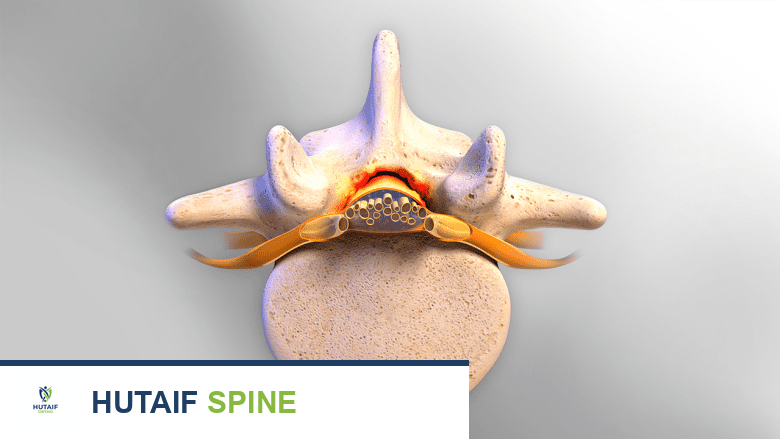 صورة توضيحية لـ آلام الظهر والجماع: دليل شامل لحياة حميمة أفضل مع الأستاذ الدكتور محمد هطيف