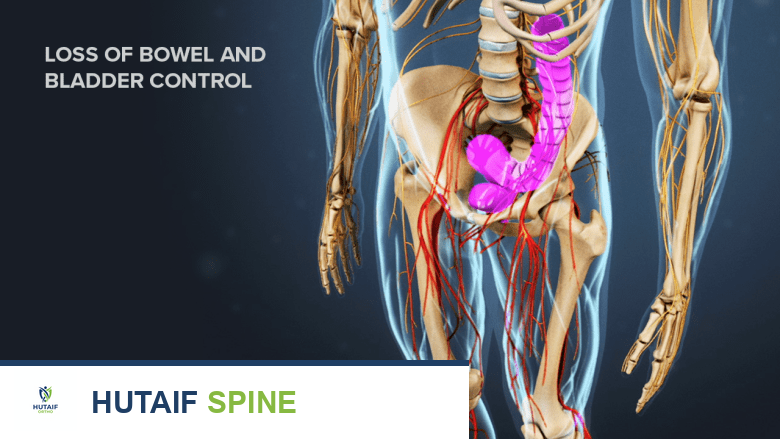 آلام الظهر أثناء الحمل: دليل شامل من الأستاذ الدكتور محمد هطيف