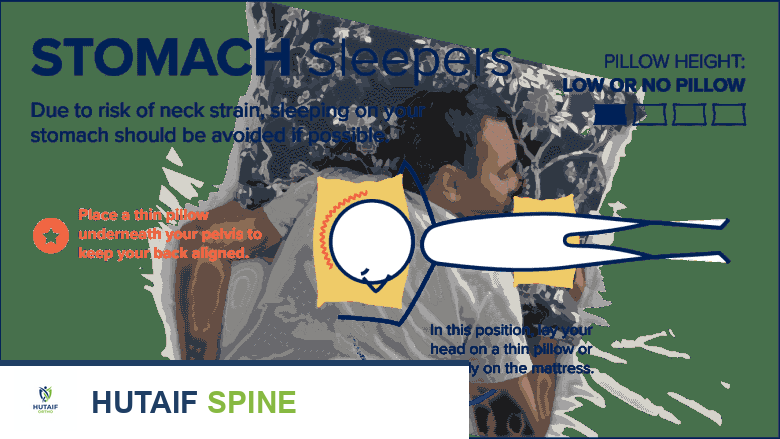 رسم توضيحي يوضح لمن ينامون على البطن والوسائد المستخدمة لهم.