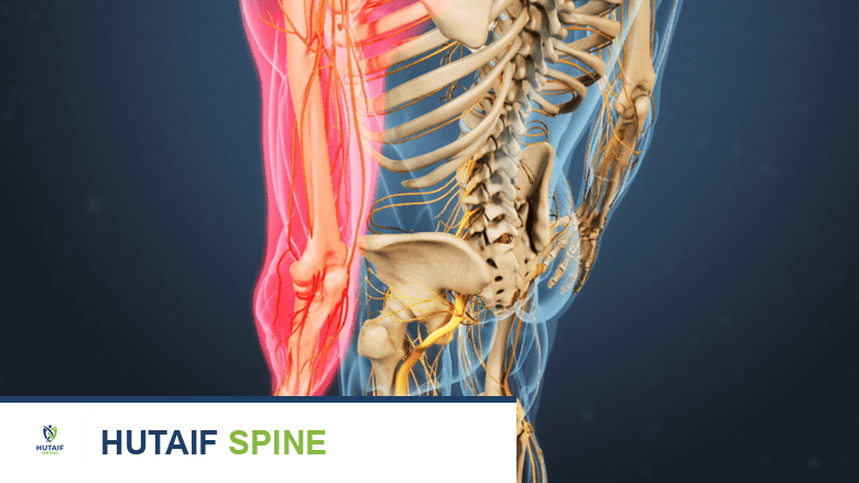 صورة توضيحية لـ أعراض التهاب الضفيرة العضدية (متلازمة بارسوناغ-تيرنر): دليلك الشامل
