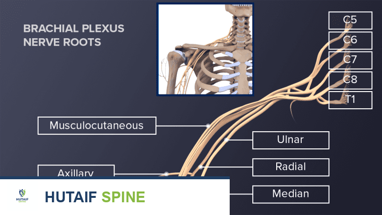 صورة توضيحية لـ أعراض التهاب الضفيرة العضدية (متلازمة بارسوناغ-تيرنر): دليلك الشامل