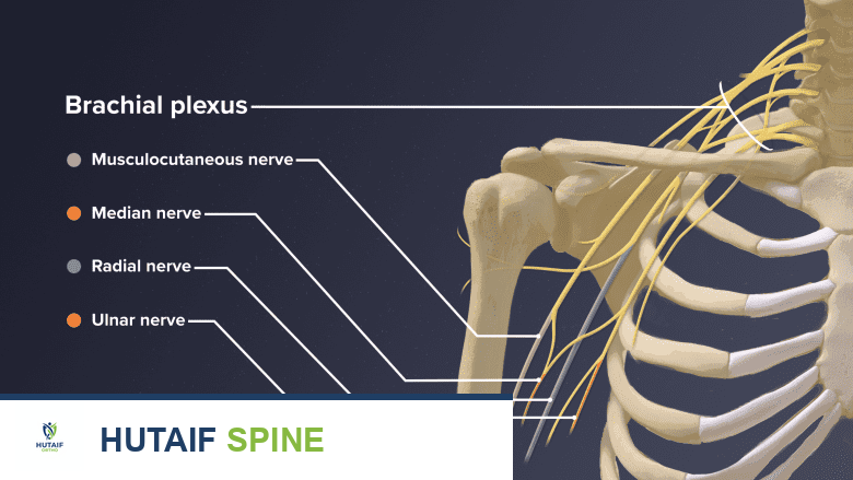 صورة توضيحية لـ أعراض التهاب الضفيرة العضدية (متلازمة بارسوناغ-تيرنر): دليلك الشامل