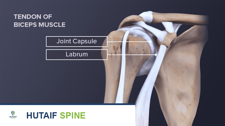 صورة توضيحية لـ علاج التهاب الضفيرة العضدية (متلازمة بارسوناج-تورنر) دليل شامل للمرضى