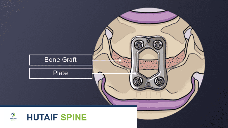 علاج آلام الفقرات العنقية C1-C2: دليل شامل من الأستاذ الدكتور محمد هطيف