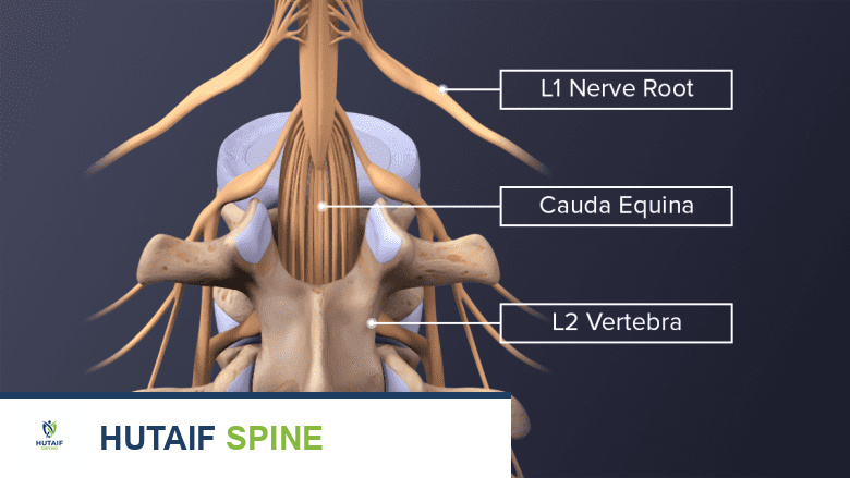 متلازمة ذيل الفرس: دليل شامل للمرضى مع الأستاذ الدكتور محمد هطيف في صنعاء