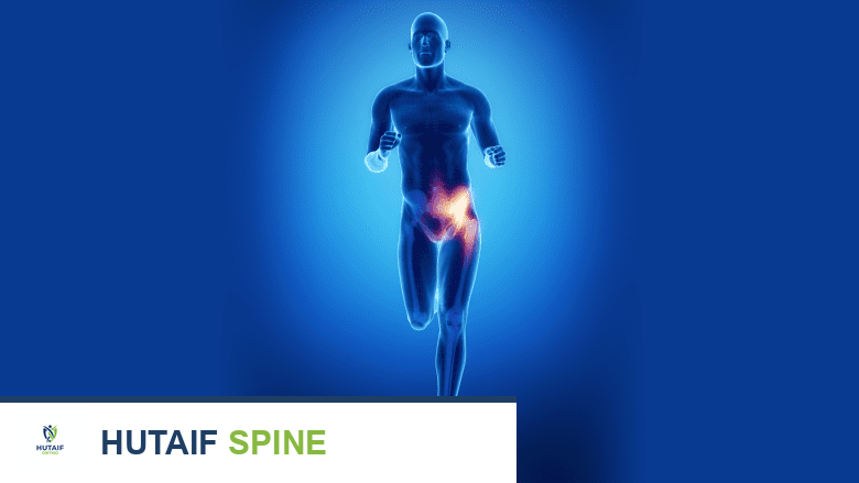 تصوير ثلاثي الأبعاد لرجل بشري يقف على ساق واحدة وهو يركض. مع تسليط الضوء على الورك باللون البرتقالي.