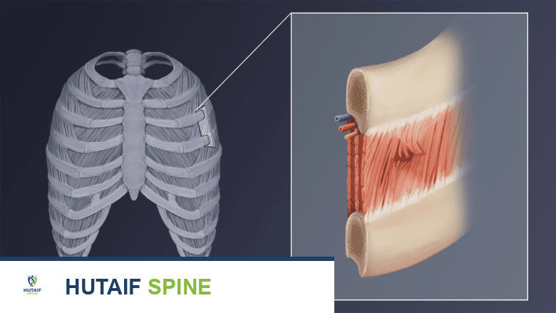 أسباب آلام الظهر العلوي: دليل شامل من الأستاذ الدكتور محمد هطيف في صنعاء