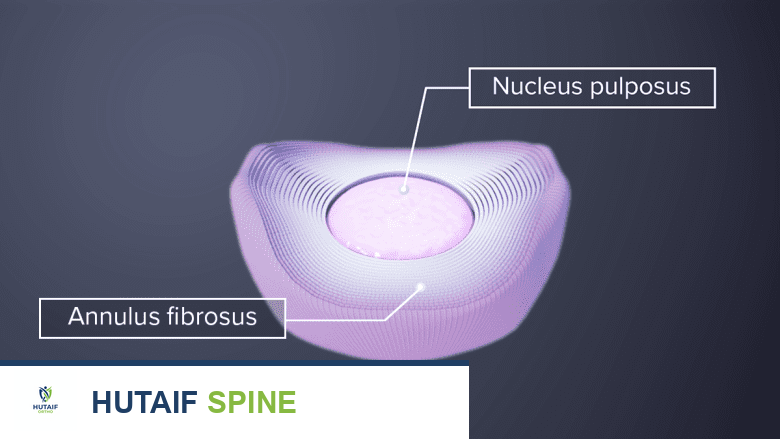 الأقراص الرقبية: دليلك الشامل لآلام الرقبة وعلاجها مع الأستاذ الدكتور محمد هطيف