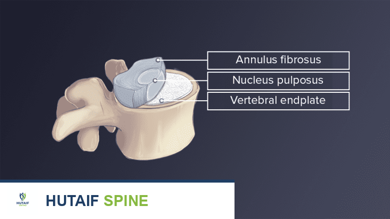 رسم توضيحي لفقرة عنقية يظهر العظم والقرص والصفيحة النهائية.
