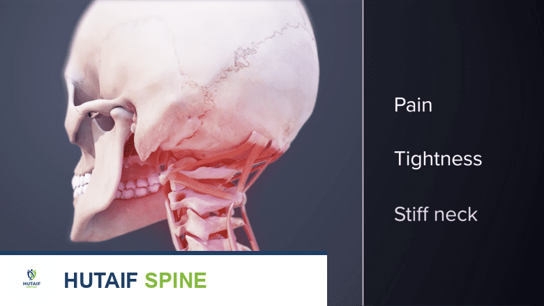 تضيق الثقبة العنقية: دليلك الشامل للأعراض والتشخيص والعلاج الفعال