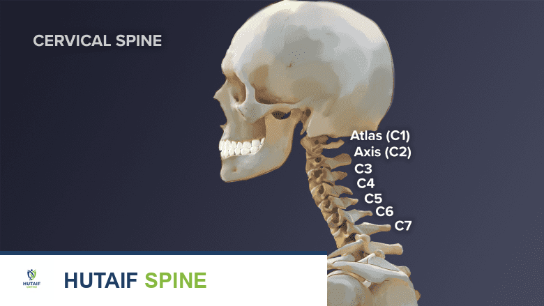 صورة توضيحية لـ خشونة فقرات الرقبة: دليل شامل للأعراض، التشخيص، والعلاج مع الأستاذ الدكتور محمد هطيف