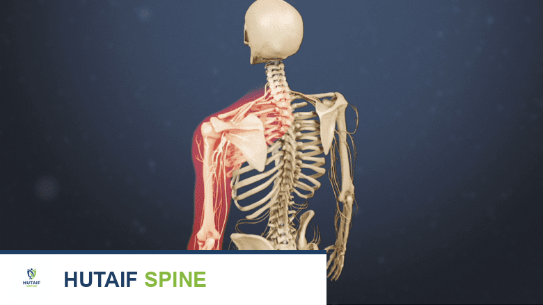 صورة توضح الجزء العلوي من الجسم مع ذراع واحدة مظللة باللون الأحمر.