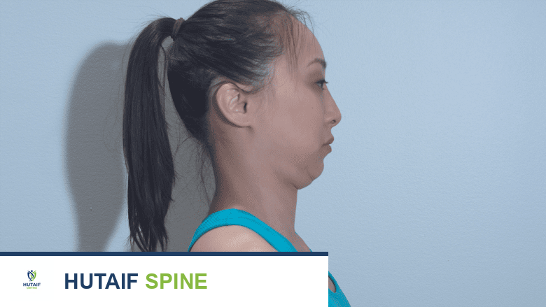 امرأة تؤدي تمرين ثني الذقن لتقوية عضلات الرقبة