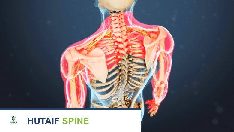 الضعف الشديد والخدر في الذراعين يتطلبان عناية طبية فورية