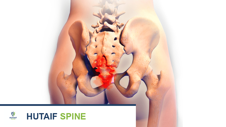 ألم العصعص (عظم الذنب) أعراضه، أسبابه، وتشخيصه الدقيق مع الأستاذ الدكتور محمد هطيف