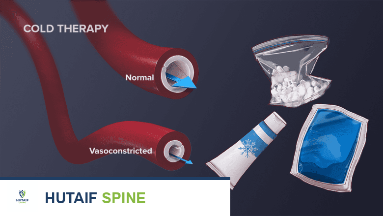 علاج عرق النسا الشامل: دليل المريض للعلاج بالكمادات الباردة والساخنة وخيارات أخرى مع الأستاذ الدكتور محمد هطيف