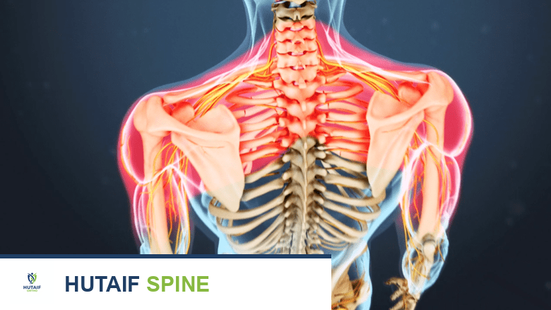 مرض القرص التنكسي الأسباب الأعراض التشخيص والعلاج مع الأستاذ الدكتور محمد هطيف