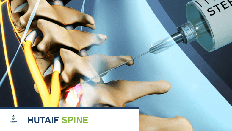 Medical illustration showing cervical spine and a needle injected into it.