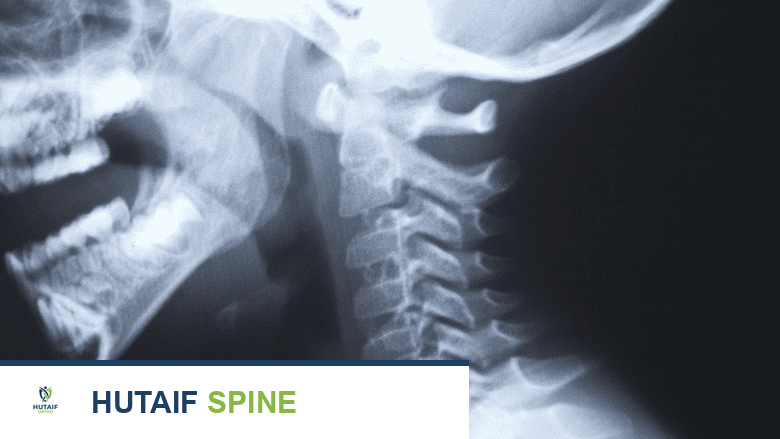 Medical illustration showing head and neck x-ray.