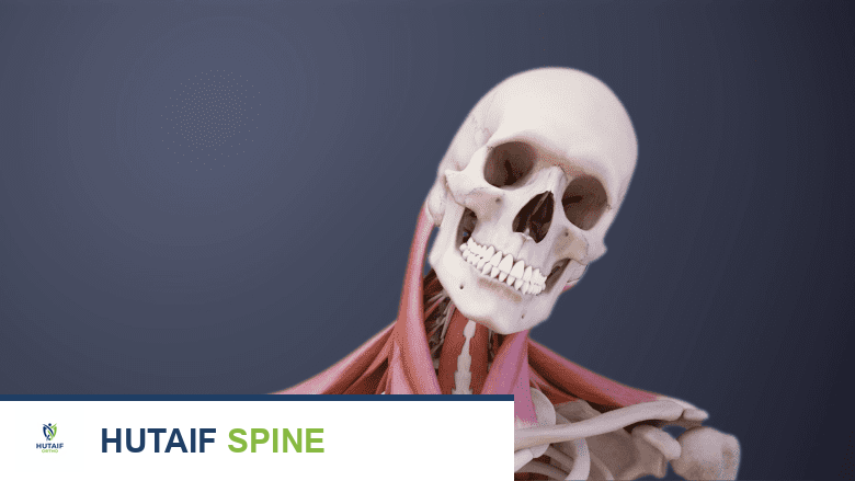 Medical illustration showing stiff neck.