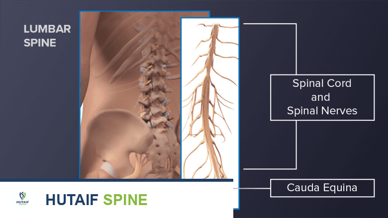 صورة توضيحية لـ حقن الستيرويد فوق الجافية: دليل شامل للمخاطر والآثار الجانبية مع الأستاذ الدكتور محمد هطيف