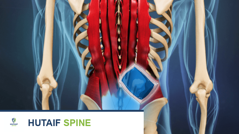 توضيح يظهر الجزء الخلفي من الجذع مع أيقونة كيس ثلج في أسفل الظهر.