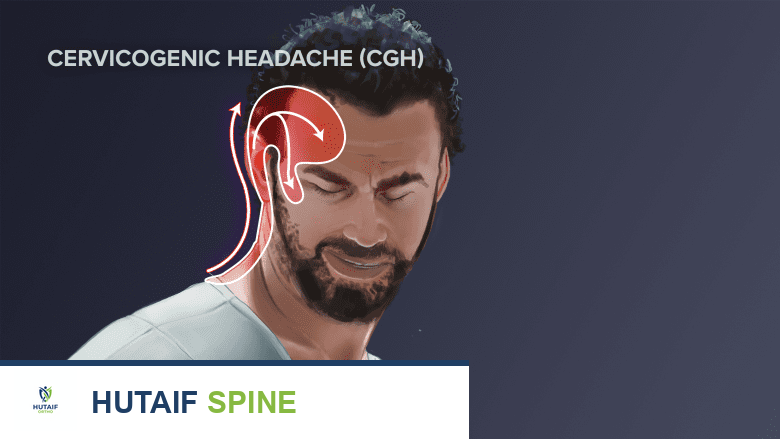 صورة توضيحية لـ وضع الرأس الأمامي وتأثيره على العمود الفقري العنقي: دليل شامل من الأستاذ الدكتور محمد هطيف