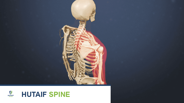 الرعاية بالمستشفى بعد جراحة استبدال القرص العنقي الاصطناعي: دليلك الشامل للتعافي