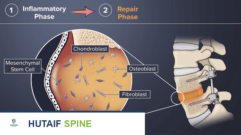 مرحلة إصلاح التئام العظام من الاندماج.
