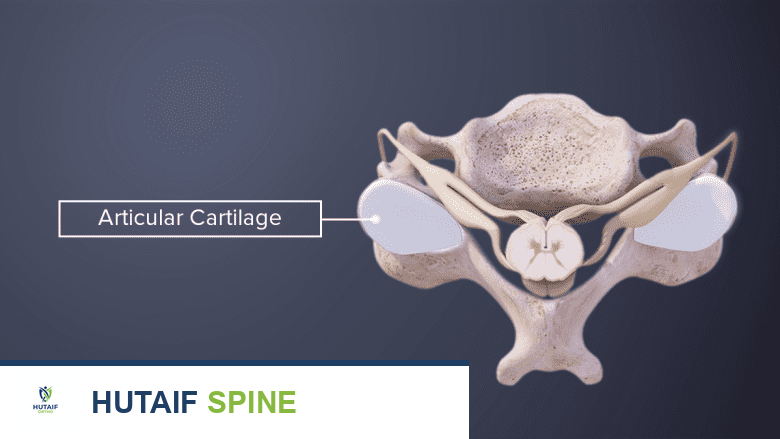 تنكس مفاصل الرقبة الفقارية: دليل شامل للأسباب، الأعراض، التشخيص، والعلاج مع الأستاذ الدكتور محمد هطيف في صنعاء
