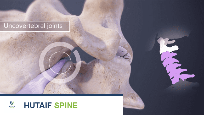 صورة توضيحية لـ تنكس مفاصل الرقبة الفقارية: دليل شامل للأسباب، الأعراض، التشخيص، والعلاج مع الأستاذ الدكتور محمد هطيف في صنعاء