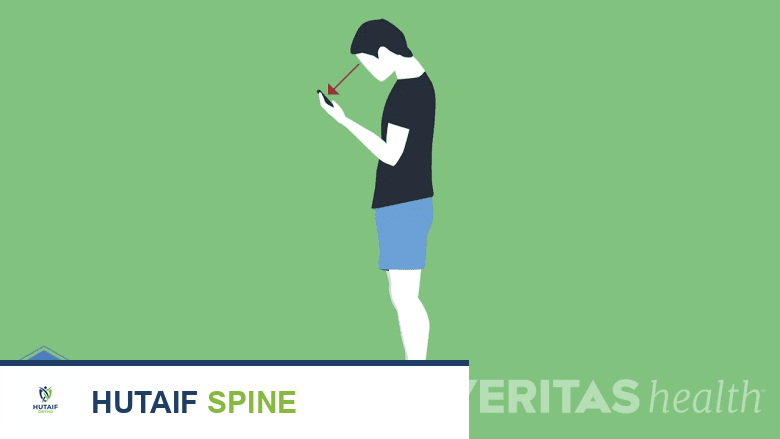 رقبة الرسائل النصية: الأسباب، الأعراض، وطرق العلاج والوقاية الشاملة مع الأستاذ الدكتور محمد هطيف