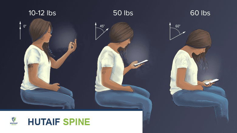صورة ثلاثية الأبعاد توضح زيادة الضغط على الرقبة مع زيادة انحناء الرأس إلى الأمام أثناء استخدام الهاتف.