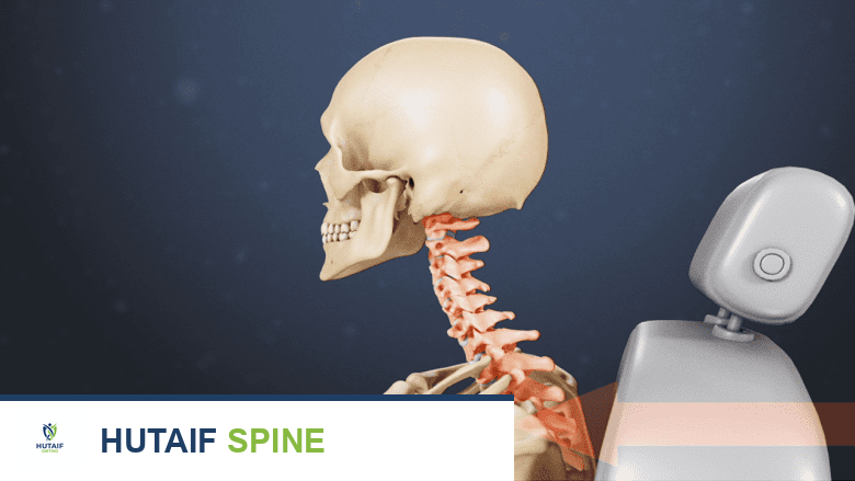 تصلب الرقبة بعد النوم: دليل شامل للتشخيص والعلاج والوقاية مع الأستاذ الدكتور محمد هطيف