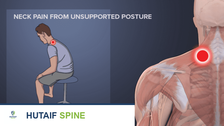 صورة توضيحية لـ تصلب الرقبة في المكتب: دليلك الشامل للعلاج والوقاية مع الأستاذ الدكتور محمد هطيف