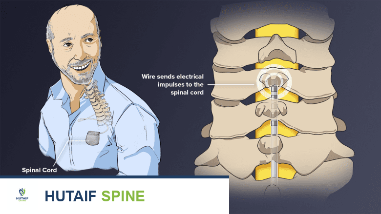 الرنين المغناطيسي للعمود الفقري دواعي الاستخدام وموانعه كل ما تحتاج معرفته