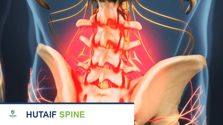 ألم الظهر مقتصر على منطقة أسفل الظهر.