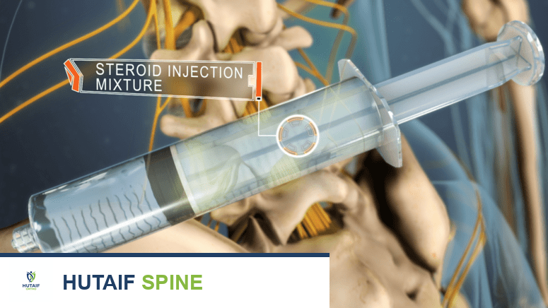 حقن الظهر والرقبة: حلول متقدمة وفعالة لآلام العمود الفقري المزمنة