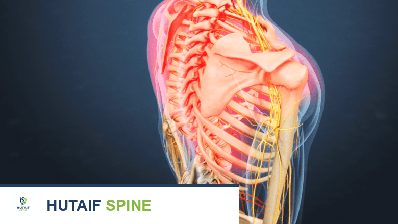 إجهاد العضلات الوربية الأعراض، الأسباب، التشخيص، والعلاج مع الأستاذ الدكتور محمد هطيف
