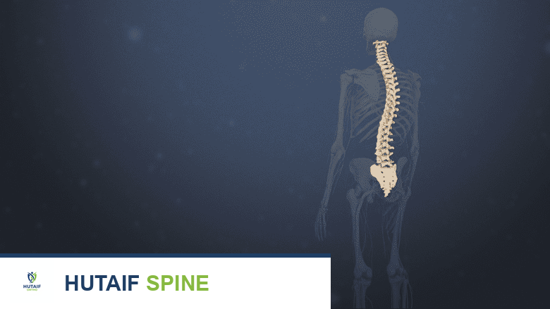الجنف في العمود الفقري البالغ