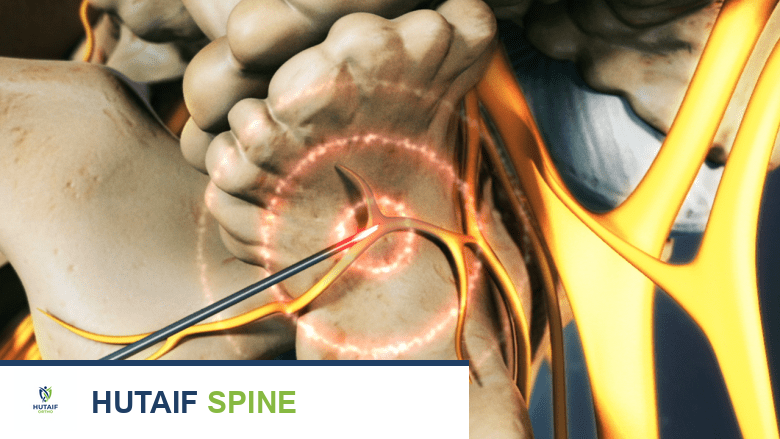 علاج مشاكل الفقرات L5-S1: دليل شامل للتعافي من آلام أسفل الظهر والساقين