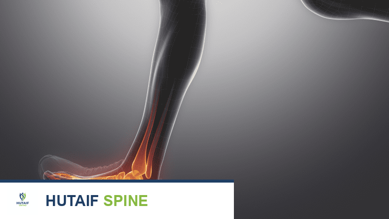 ألم في القدم من المشي.